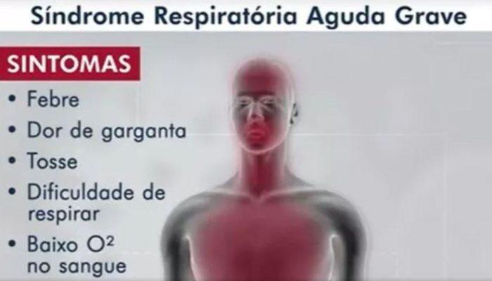 sindrome-respiratoria-aguda-grave-sintomas-1-.jpg